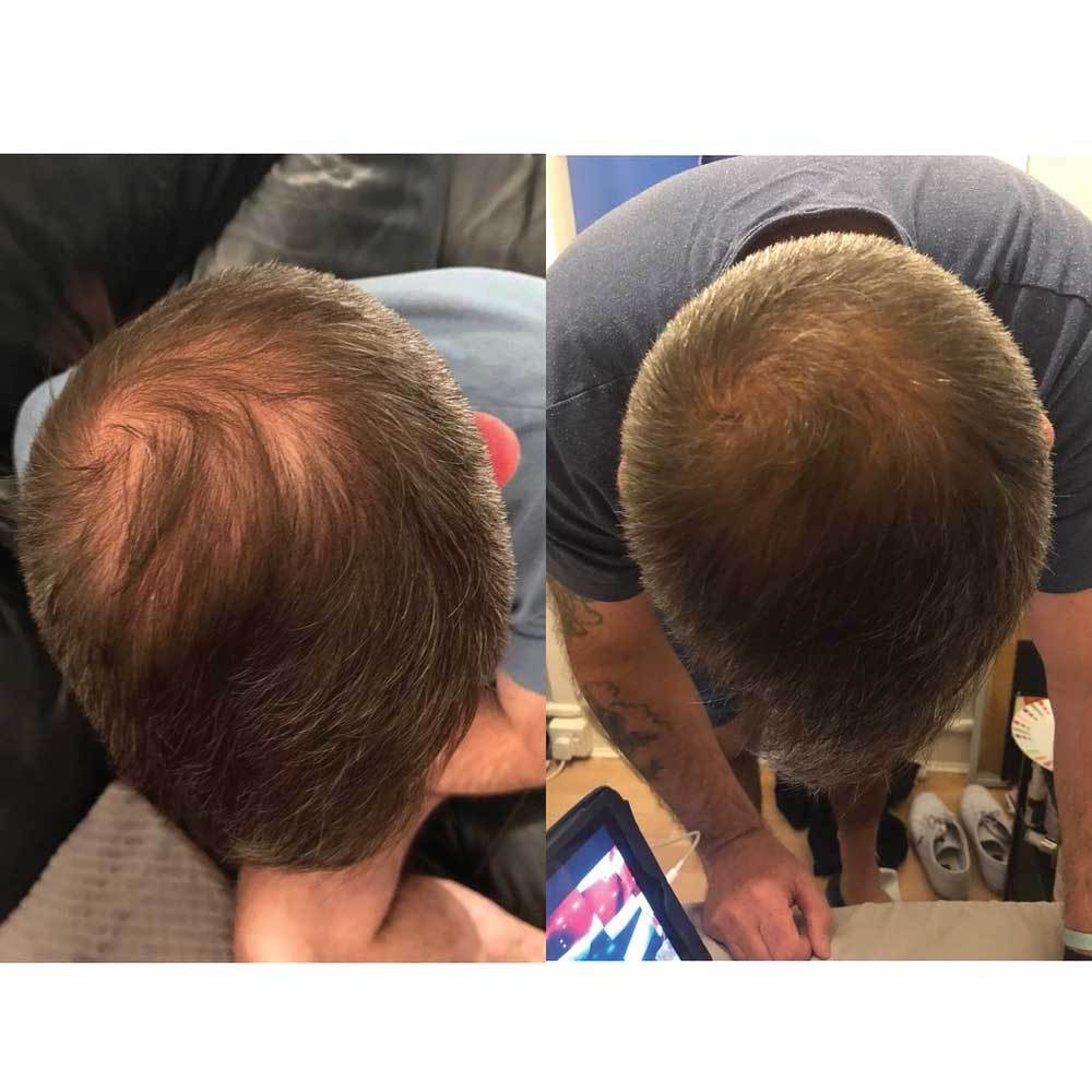 Watermans Grow More Elixir 100ml Hair Growth Serum Biotin Regrowth Topical Scalp 5