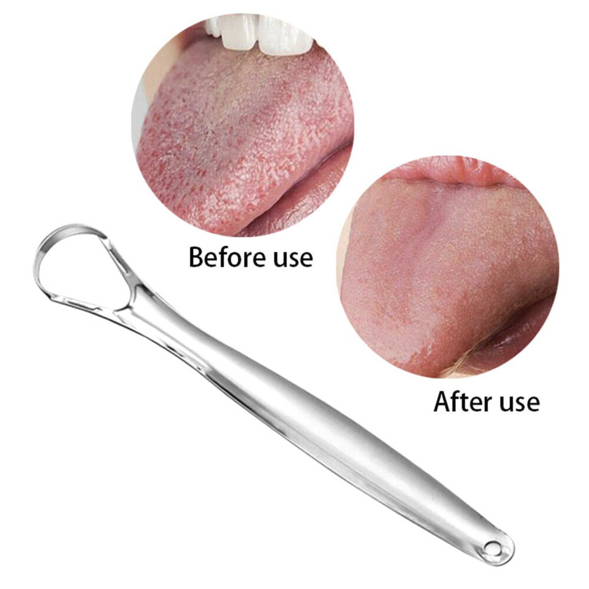 Stainless Steel Tongue Scraper Cleaner Oral Hygiene Reduce Bad Breath Metal Tool 6