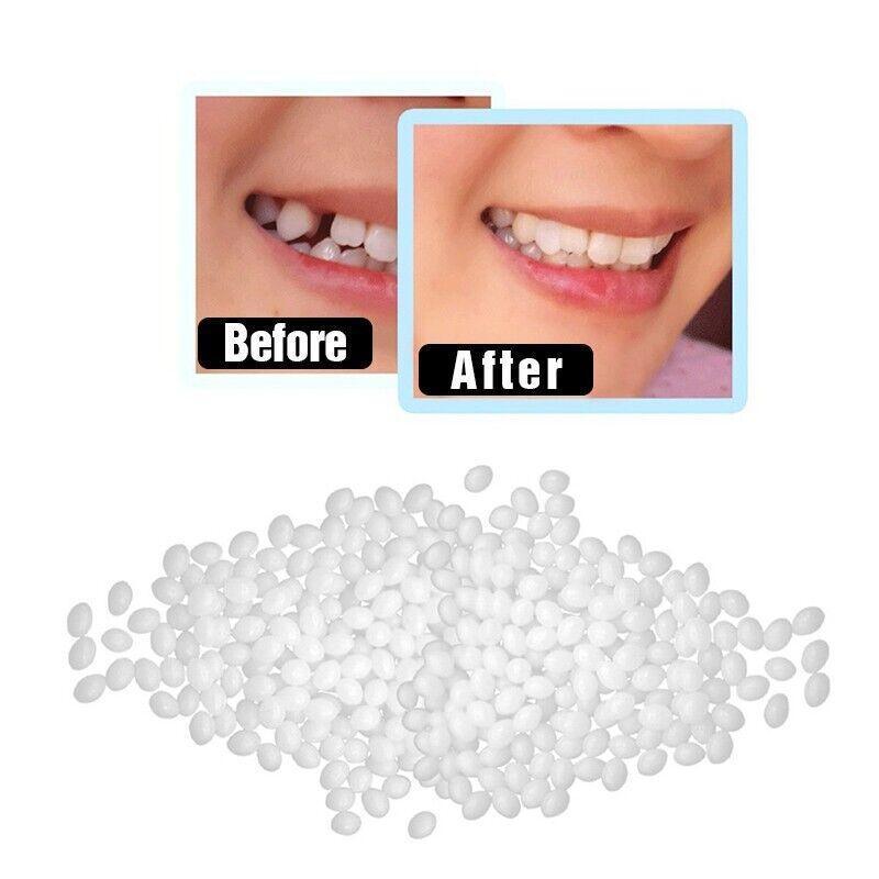 Temporary Tooth Repair Kit Teeth Gaps False Teeth Solid Glue Denture Adhesive - 10G 3