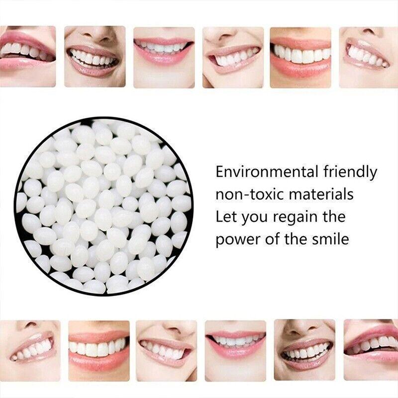 Temporary Tooth Repair Kit Teeth Gaps False Teeth Solid Glue Denture Adhesive - 10G 5