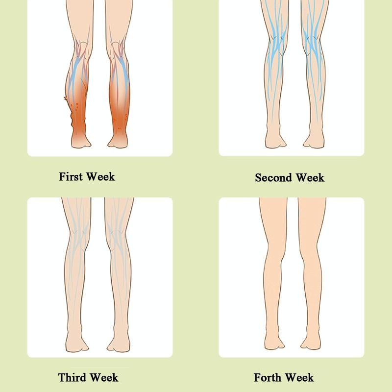 Calf Air Wave Massager Household Varicose Vein Physiotherapy Device Upgrade Fever Type 6