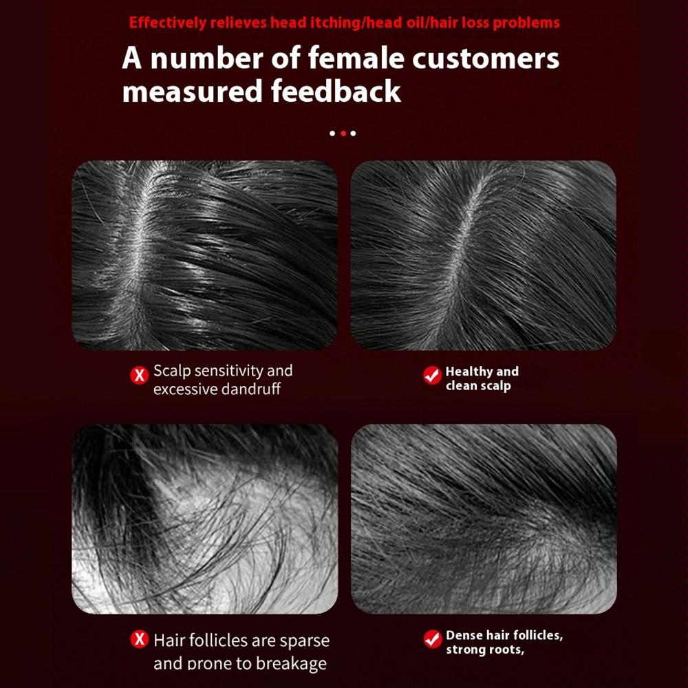 Red Light Scalp Massage Comb For Hair Growth 630Nm Liquid Care - Red 11