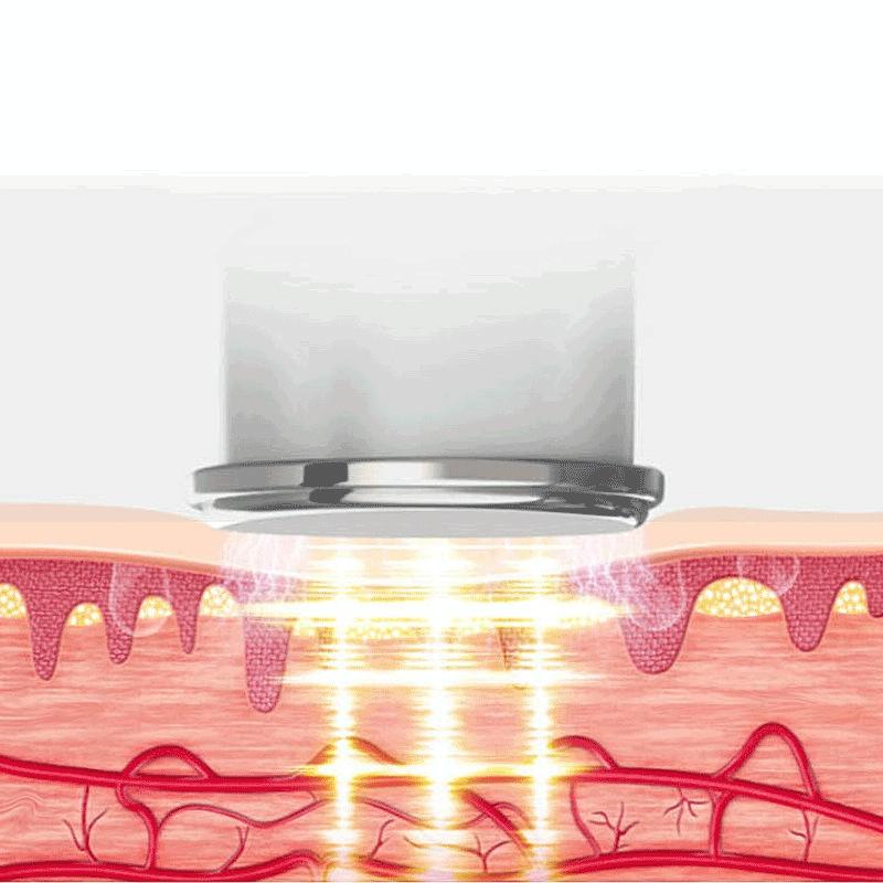 Hot Compress Shoulder & Neck Massager 2 Ends White 6