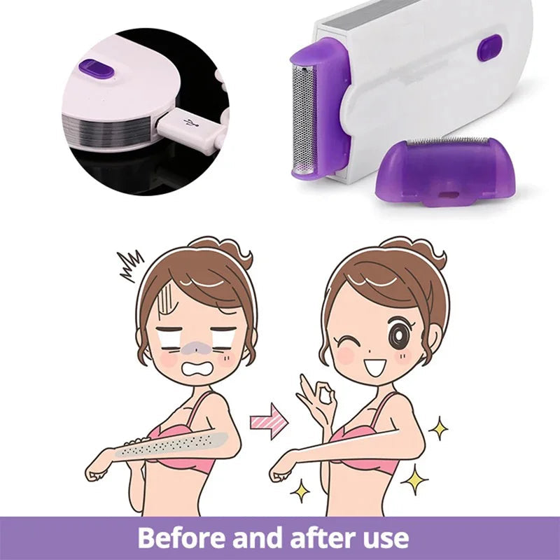 NNEOBA Painless Laser Touch Epilator Kit 4