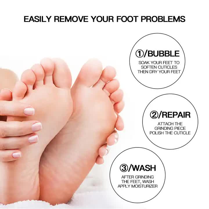 Gray Electric Foot Callus Remover - Portable Pedicure Tool for Smooth Feet 5