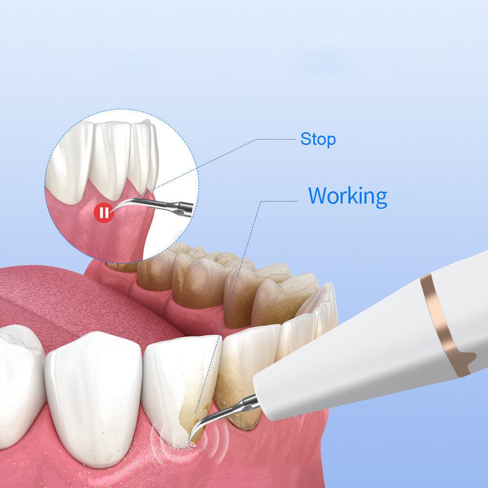 3-Speed Ultrasonic Electric Dental Cleaner with LED Light and Type-C Charging - Professional Plaque Remover Kit 4