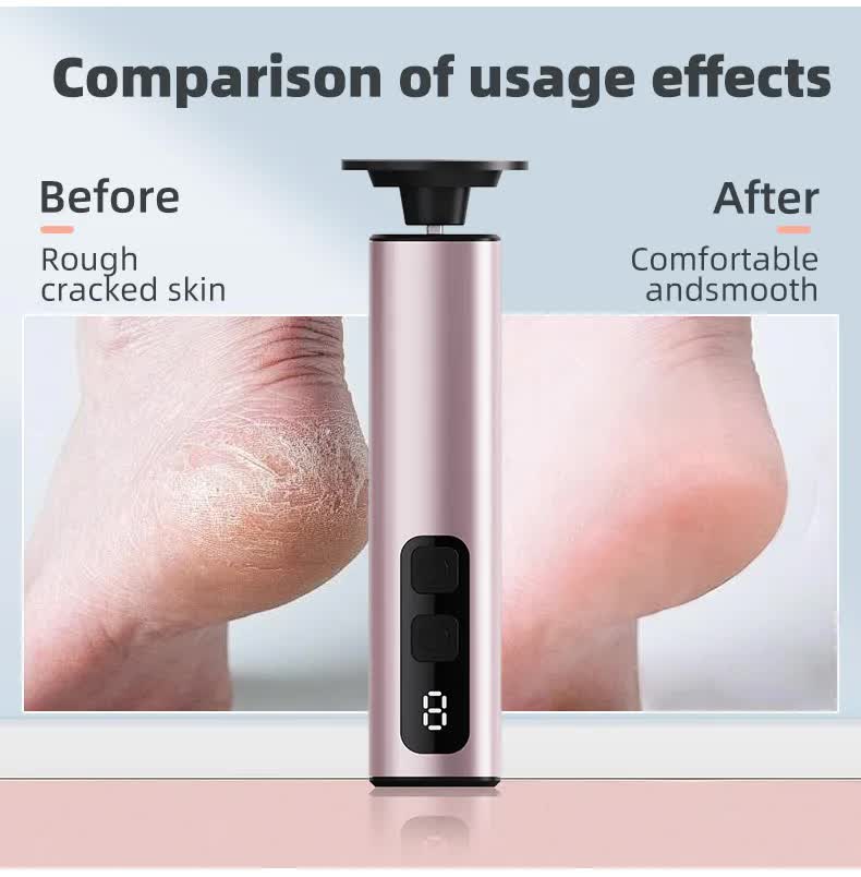 Grey Rechargeable Electric Foot File with 9 Speed Settings - Callus Remover for Smooth Feet 14