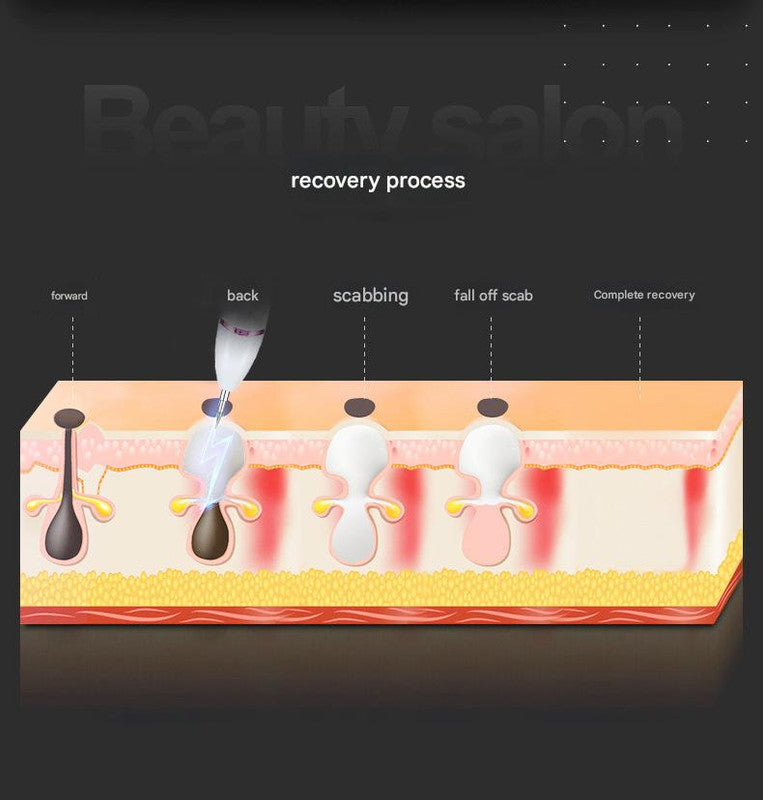 Professional 9-Level Skin Tag & Spot Remover Pen - USB Rechargeable Beauty Device(gold) 5