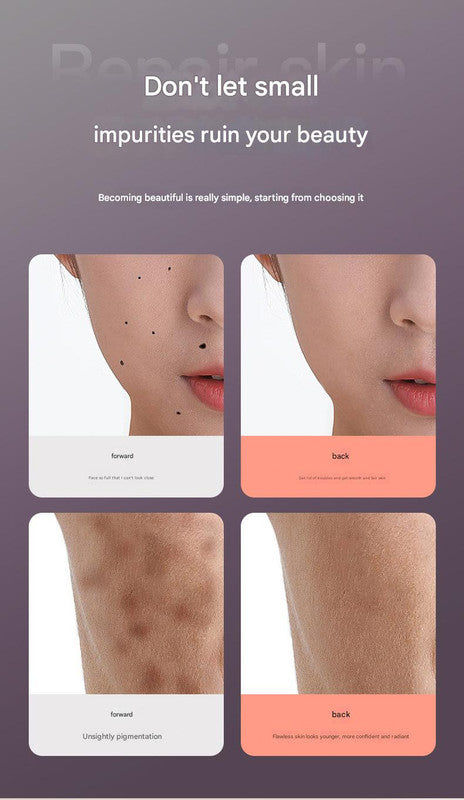 Professional 9-Level Skin Tag & Spot Remover Pen - USB Rechargeable Beauty Device(Silver) 4