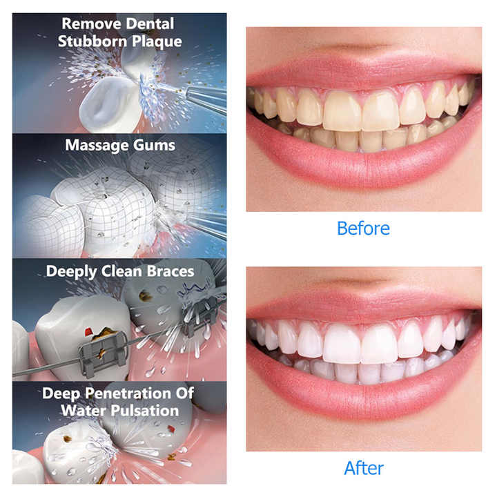 Black Advanced Portable Water Flosser - Rechargeable Oral Irrigator, IPX7 Waterproof, 4 Cleaning Modes for Deep Dental Care 5