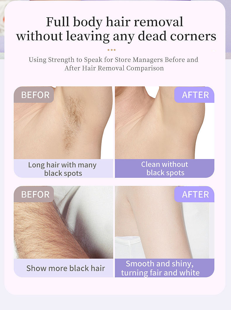 5-in-1 Electric Lady Shaver & Grooming Kit - LCD Display, USB-C Rechargeable, Full Body Hair Removal(White) 7