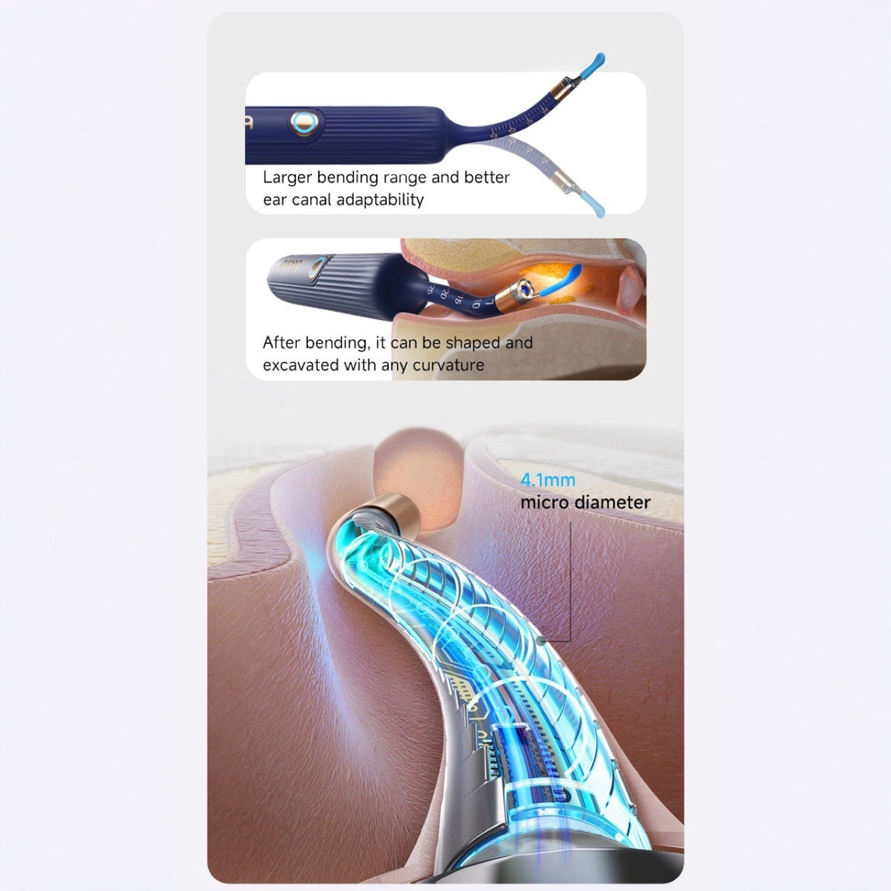 Smart Visual Ear Cleaner with HD Endoscope & Precision Tweezers - Safe for Adults & Children(blue) 5