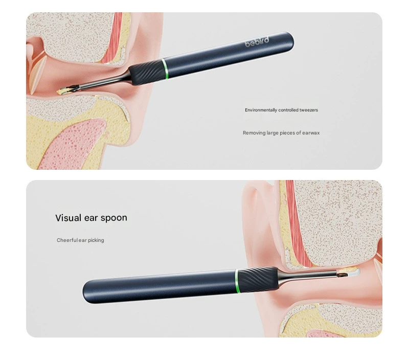 Smart Visual Ear Cleaner with HD Endoscope & Precision Tweezers - Safe for Adults & Children(Dark blue) 4