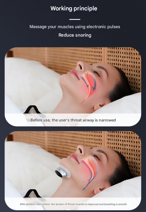 Black Smart Anti-Snoring Device - Rechargeable Pulse Throat Stimulator for Quieter Sleep 4
