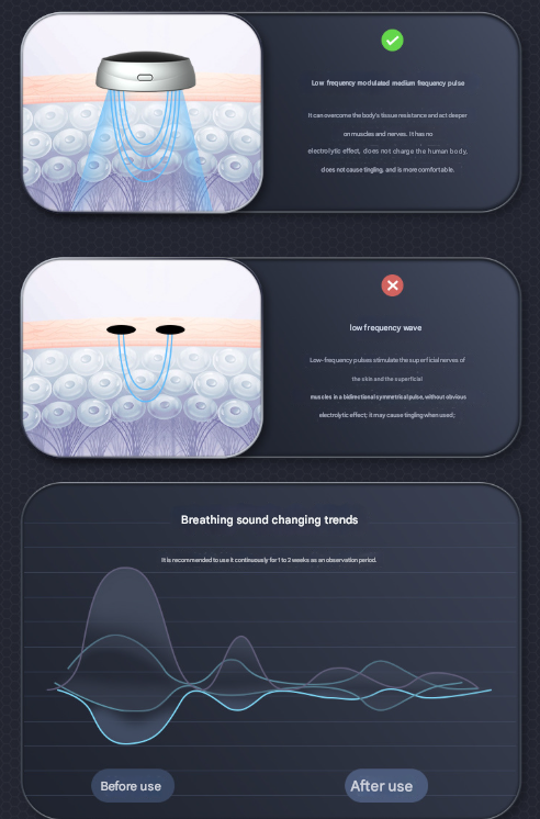 Black Smart Anti-Snoring Device - Rechargeable Pulse Throat Stimulator for Quieter Sleep 5