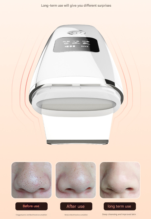 White Professional 4-in-1 Ultrasonic Skin Scrubber - Deep Pore Cleanser, Blackhead Remover & EMS Facial Lifting Tool 4