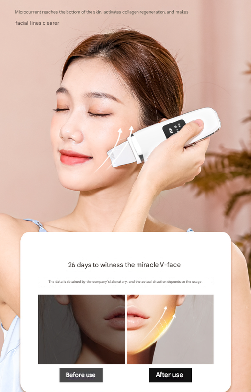 White Professional 4-in-1 Ultrasonic Skin Scrubber - Deep Pore Cleanser, Blackhead Remover & EMS Facial Lifting Tool 8